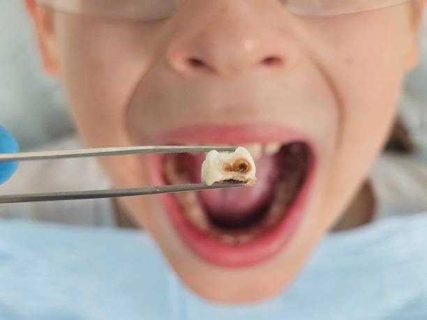 Best Tooth Infection Emergency Dentist  in Brinckerhoff, NY
