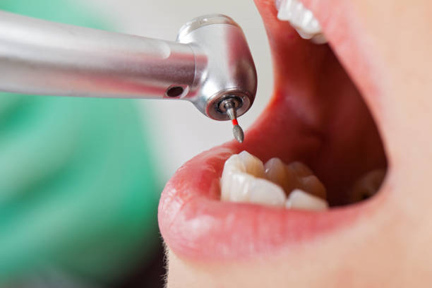 Best Dentist for Tooth Abscess  in Brinckerhoff, NY